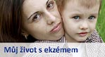 Můj život s ekzémem